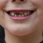 CURA DEI DENTI_1