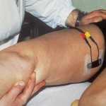 foto 2 biofeedback