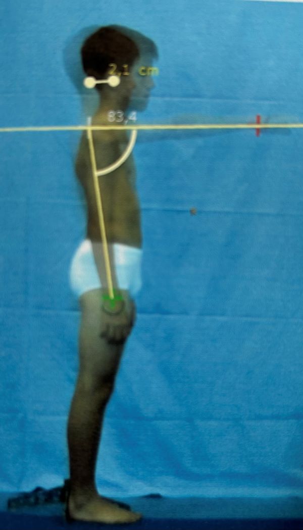 foto 1 n. 178